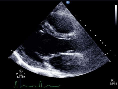 how to read an echocardiogram report|Making sense of an echocardiogram report .